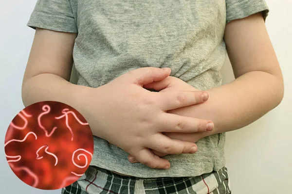 dấu hiệu đau bụng giun ở trẻ